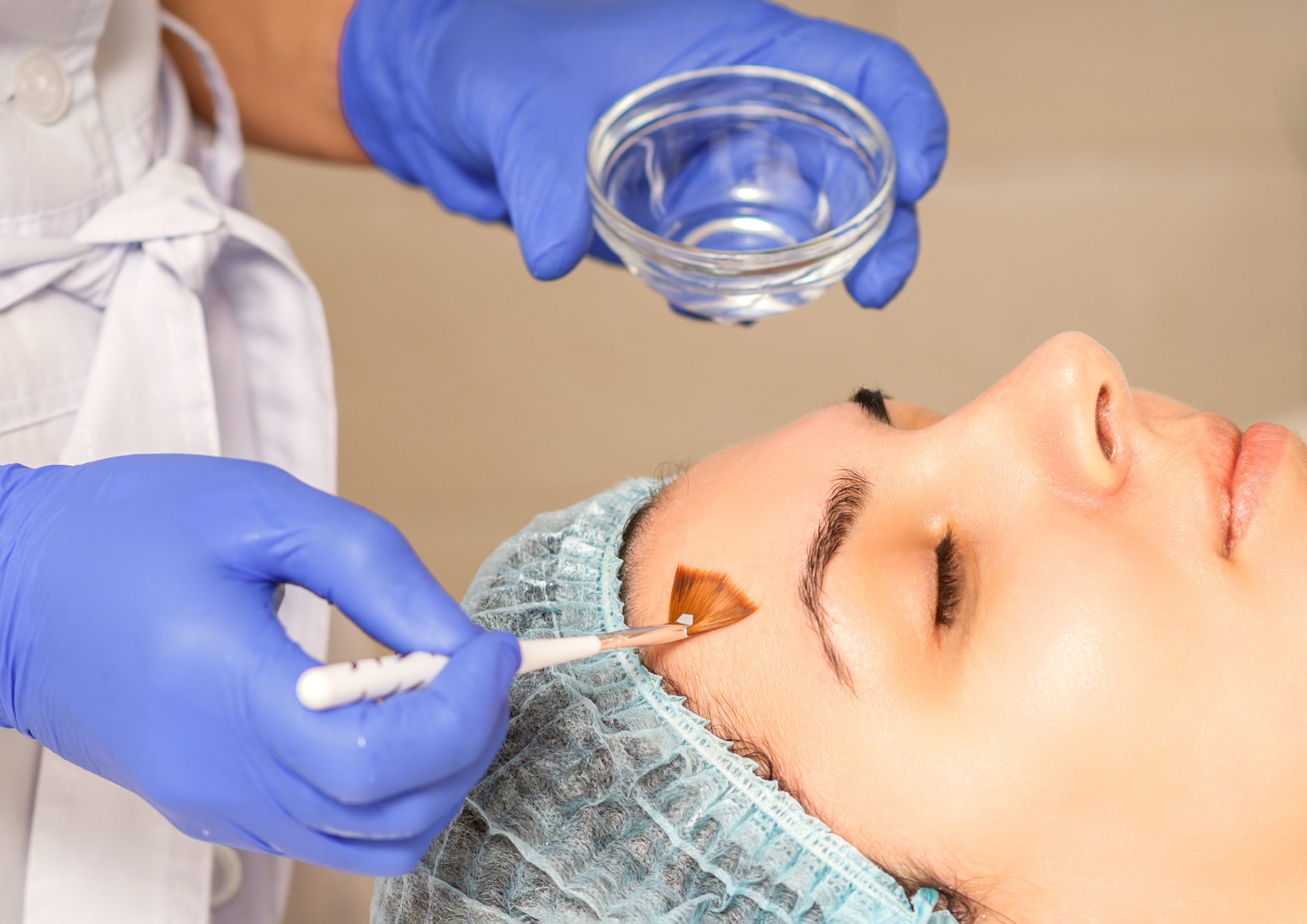 Salicylic Acid 30% - Image 2