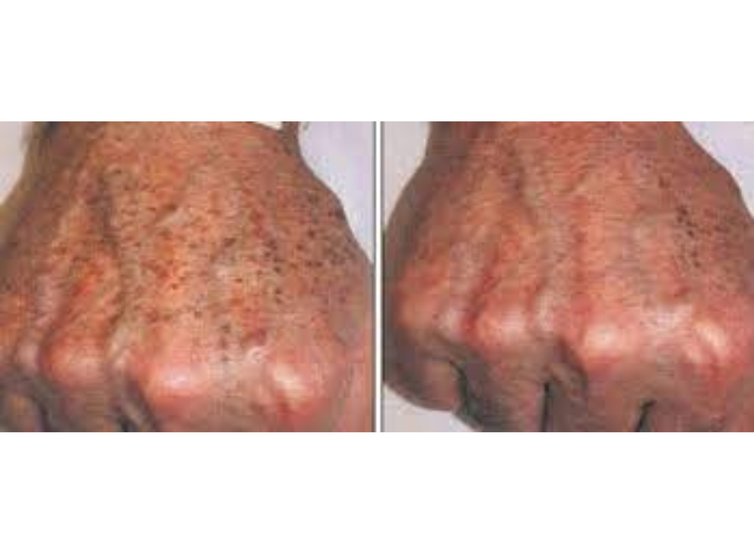 Purple Peel 25 - Image 3